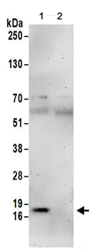 Immunoprecipitation - Anti-SNRPD3/Sm-D3 antibody (AB157118)