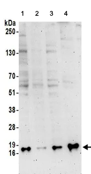 Western blot - Anti-SNRPD3/Sm-D3 antibody (AB157118)
