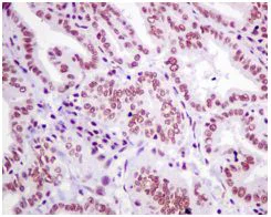 Immunohistochemistry (Formalin/PFA-fixed paraffin-embedded sections) - Anti-SNRPF antibody [EPR10388] - BSA and Azide free (AB249169)