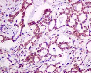 Immunohistochemistry (Formalin/PFA-fixed paraffin-embedded sections) - Anti-SNRPF antibody [EPR10388] - BSA and Azide free (AB249169)