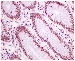 Immunohistochemistry (Formalin/PFA-fixed paraffin-embedded sections) - Anti-SNRPF antibody [EPR10388] - BSA and Azide free (AB249169)