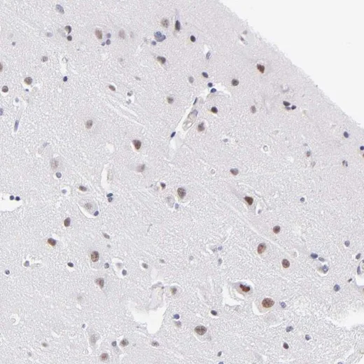 Immunohistochemistry (Formalin/PFA-fixed paraffin-embedded sections) - Anti-SNRPN antibody (AB224330)