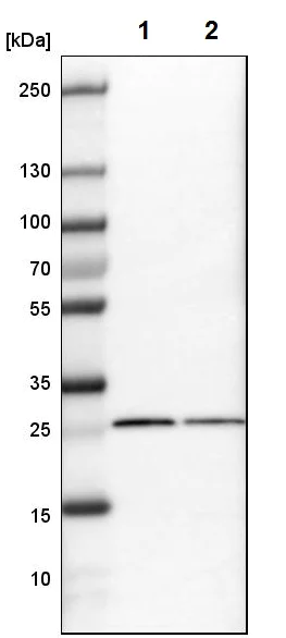 Western blot - Anti-SNRPN antibody (AB224330)