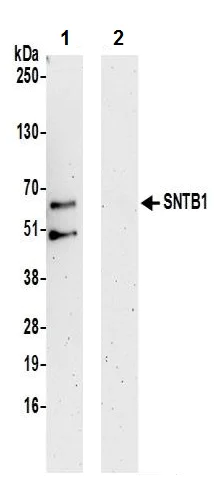 Immunoprecipitation - Anti-SNTB1 antibody (AB242046)