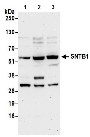 Western blot - Anti-SNTB1 antibody (AB242046)