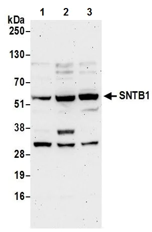 Western blot - Anti-SNTB1 antibody (AB242046)