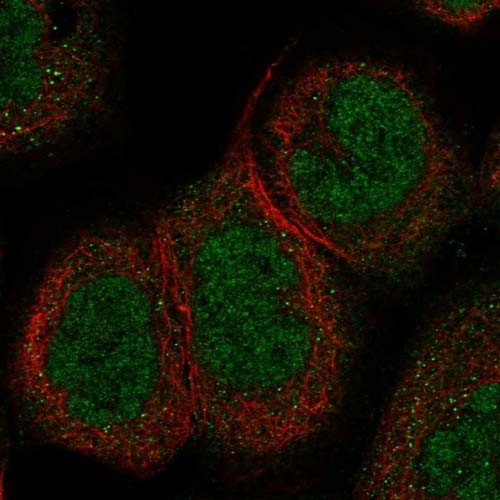 Immunocytochemistry/ Immunofluorescence - Anti-SNTN antibody (AB122845), expandable thumbnail