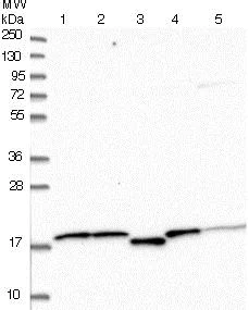 Western blot - Anti-SNTN antibody (AB122845)