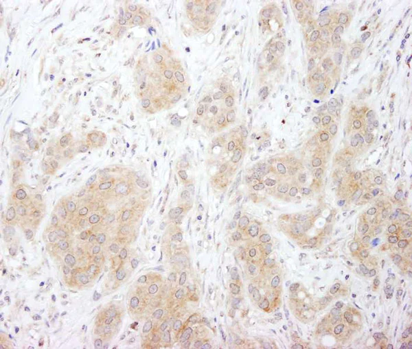 Immunohistochemistry (Formalin/PFA-fixed paraffin-embedded sections) - Anti-SNX1 antibody (AB995)