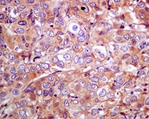 Immunohistochemistry (Formalin/PFA-fixed paraffin-embedded sections) - Anti-SNX1 antibody [EPR7178] (AB134126), expandable thumbnail
