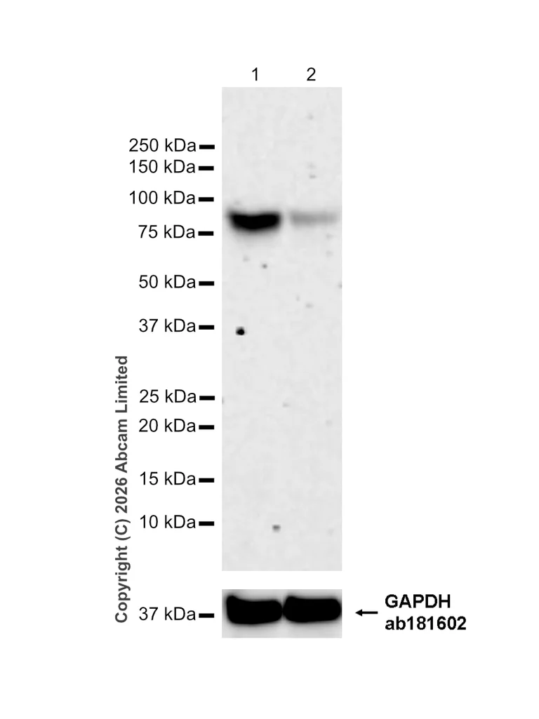 Western blot - Anti-SNX1 antibody [EPR7178] (AB134126)