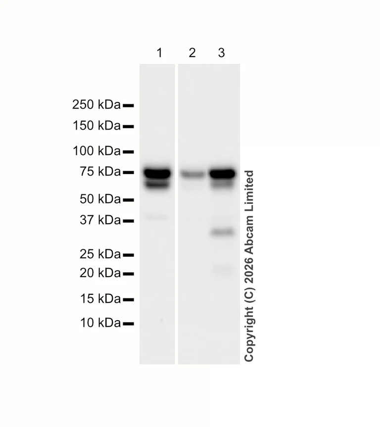 Western blot - Anti-SNX1 antibody [EPR7178] (AB134126)