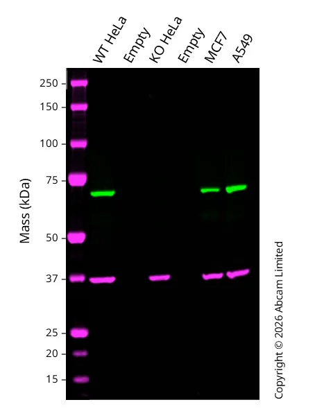 Western blot - Anti-SNX1 antibody [EPR7178] (AB134126)