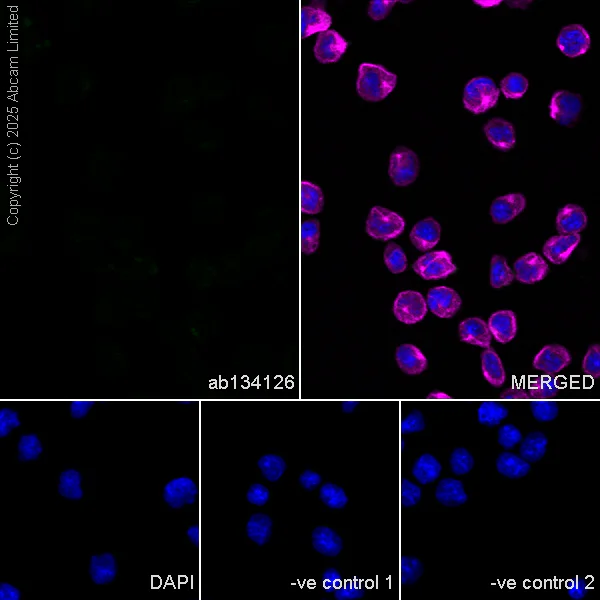 Immunocytochemistry/ Immunofluorescence - Anti-SNX1 antibody [EPR7178] - BSA and Azide free (AB248691)