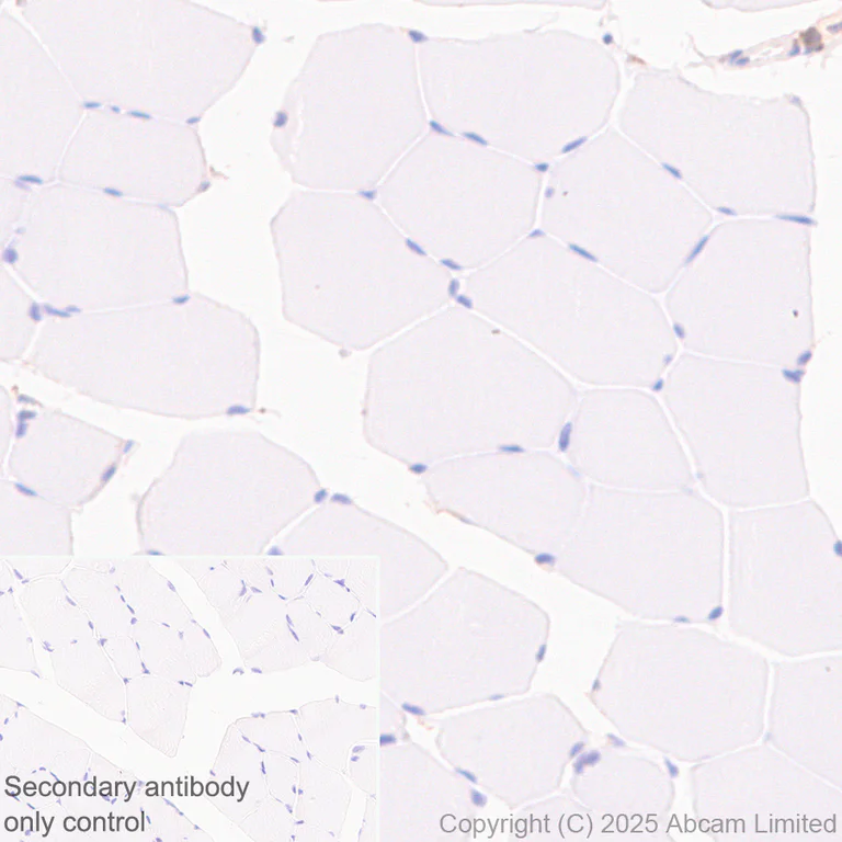 Immunohistochemistry (Formalin/PFA-fixed paraffin-embedded sections) - Anti-SNX1 antibody [EPR7178] - BSA and Azide free (AB248691)