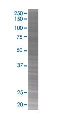 SDS-PAGE - SNX1 overexpression 293T lysate (whole cell) (AB94159), expandable thumbnail