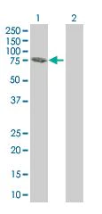 Western blot - SNX1 overexpression 293T lysate (whole cell) (AB94159)