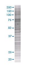 SNX1 overexpression 293T lysate (whole cell)