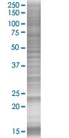 SNX10 overexpression 293T lysate (whole cell)
