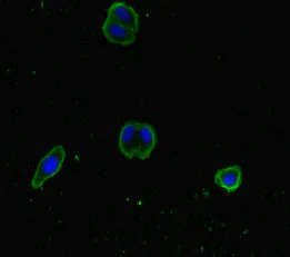 Immunocytochemistry/ Immunofluorescence - Anti-SNX14 antibody (AB222841)