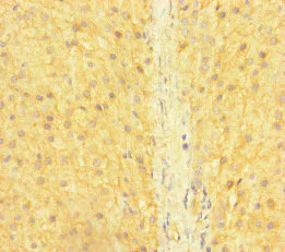 Immunohistochemistry (Formalin/PFA-fixed paraffin-embedded sections) - Anti-SNX14 antibody (AB222841)