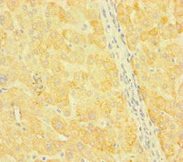 Immunohistochemistry (Formalin/PFA-fixed paraffin-embedded sections) - Anti-SNX14 antibody (AB222841)