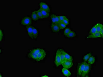 Immunocytochemistry/ Immunofluorescence - Anti-SNX17 antibody (AB223046)
