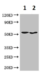 Western blot - Anti-SNX17 antibody (AB223046)