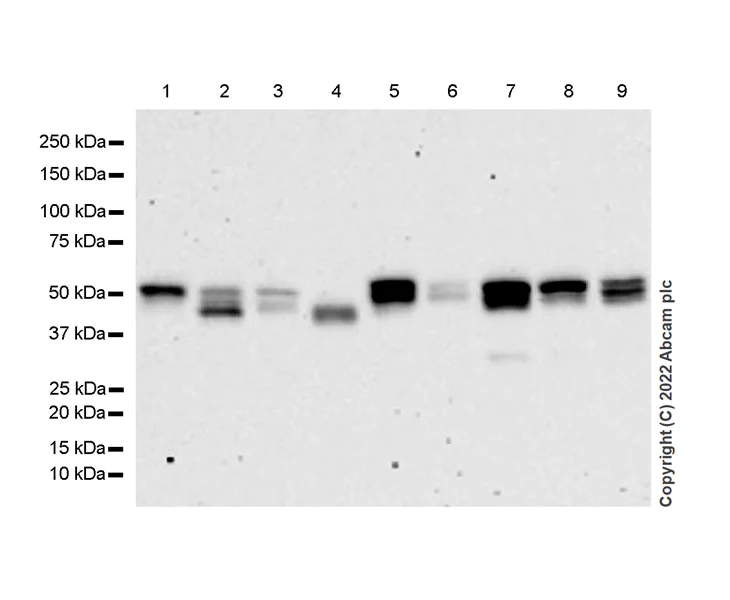 Western blot - Anti-SNX17 antibody [EPR26025-45] (AB307513)
