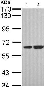 Western blot - Anti-SNX18 antibody (AB96843), expandable thumbnail
