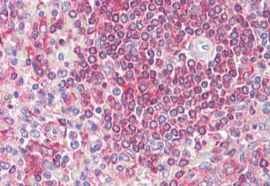 Immunohistochemistry (Formalin/PFA-fixed paraffin-embedded sections) - Anti-SNX2 antibody (AB134039)