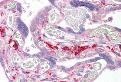 Immunohistochemistry (Formalin/PFA-fixed paraffin-embedded sections) - Anti-SNX2 antibody (AB134039)