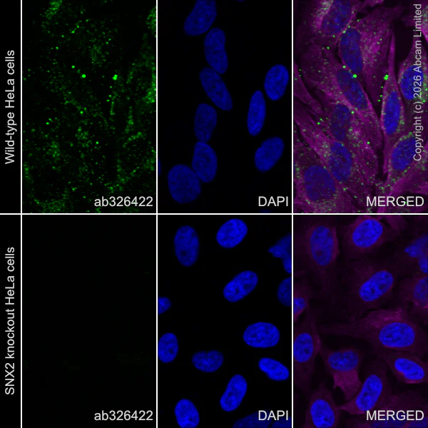 Immunocytochemistry/ Immunofluorescence - Anti-SNX2 antibody [EPR30535-531] (AB326422)