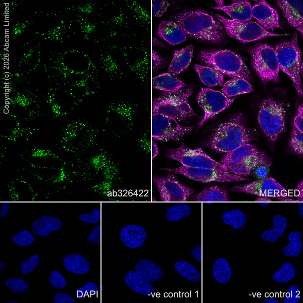 Immunocytochemistry/ Immunofluorescence - Anti-SNX2 antibody [EPR30535-531] (AB326422)