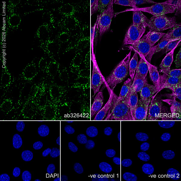 Immunocytochemistry/ Immunofluorescence - Anti-SNX2 antibody [EPR30535-531] (AB326422)