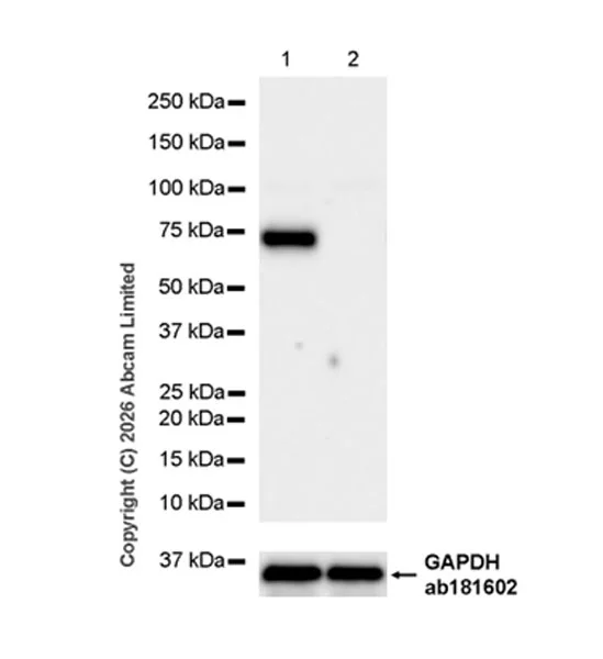 Western blot - Anti-SNX2 antibody [EPR30535-531] (AB326422)