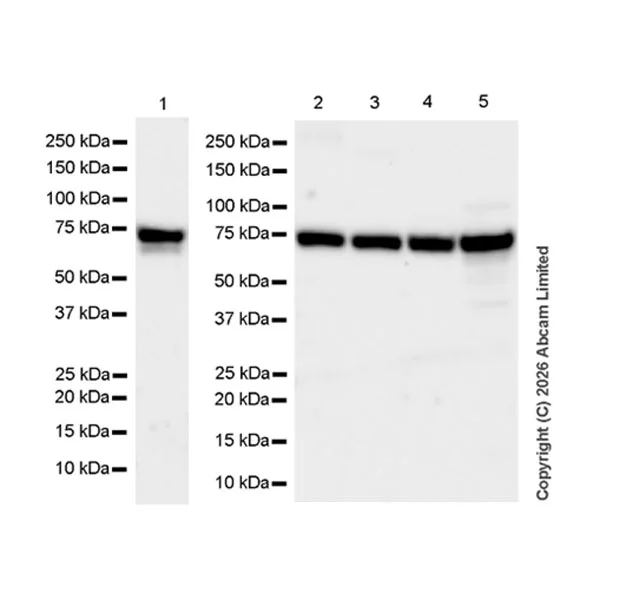 Western blot - Anti-SNX2 antibody [EPR30535-531] (AB326422)
