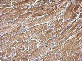 Immunohistochemistry (Formalin/PFA-fixed paraffin-embedded sections) - Anti-SNX25 antibody (AB183756)