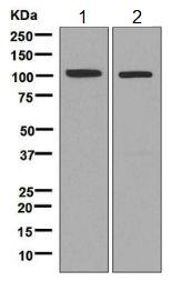 Western blot - Anti-SNX25 antibody [EPR9122] (AB140655)