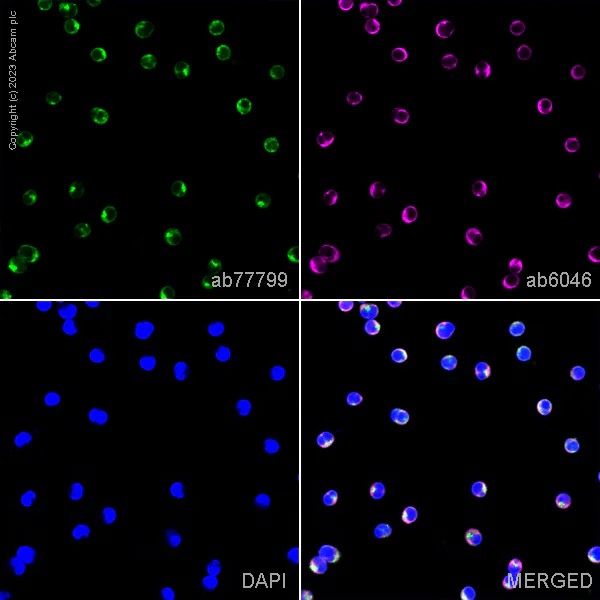 Immunocytochemistry/ Immunofluorescence - Anti-SNX27 antibody [1C6] (AB77799)