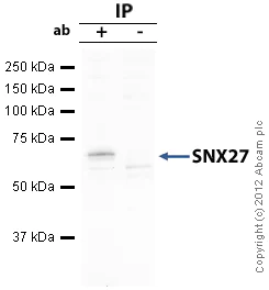 Immunoprecipitation - Anti-SNX27 antibody [1C6] (AB77799)