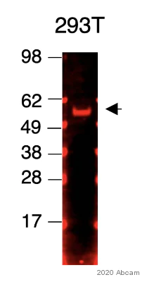 Western blot - Anti-SNX27 antibody [1C6] (AB77799)
