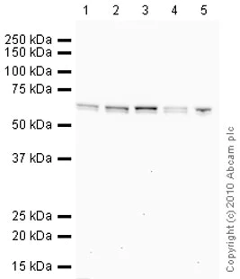 Western blot - Anti-SNX27 antibody [1C6] (AB77799)