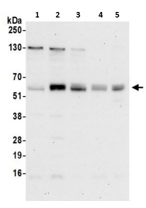 Western blot - Anti-SNX27 antibody (AB241128)