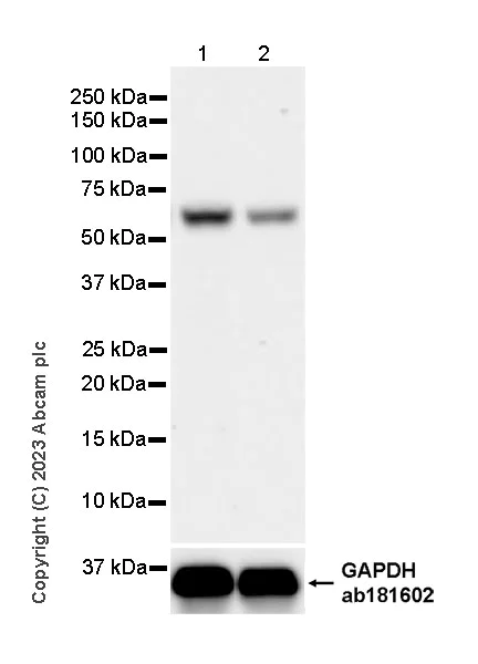Western blot - Anti-SNX27 antibody [EPR28130-16] - BSA and Azide free (AB315898)