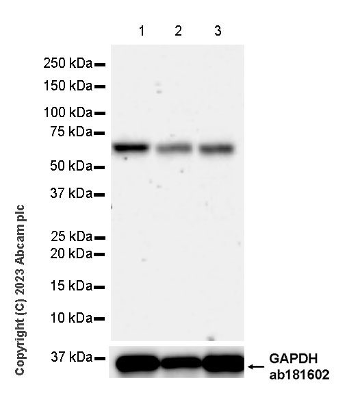 Western blot - Anti-SNX27 antibody [EPR28130-16] - BSA and Azide free (AB315898), expandable thumbnail