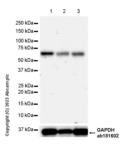 Western blot - Anti-SNX27 antibody [EPR28130-16] - BSA and Azide free (AB315898)