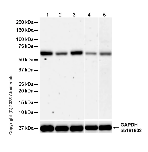 Western blot - Anti-SNX27 antibody [EPR28130-16] - BSA and Azide free (AB315898)