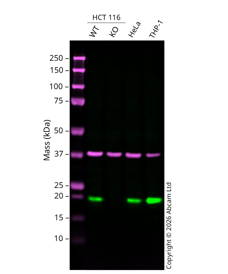 Western blot - Anti-SNX3 antibody [EPR28131-55] (AB314492)