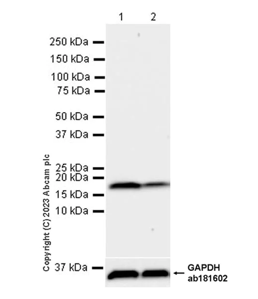 Western blot - Anti-SNX3 antibody [EPR28131-55] - BSA and Azide free (AB314493)
